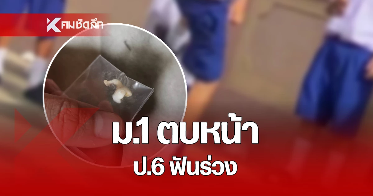 คลิป แม่สุดทน ร้องสื่อลูกชาย ป.6 ถูกรุ่นพี่ เตะอัดหลัง ซ้ำ ม.2 ตบหน้าจนฟันหลุด